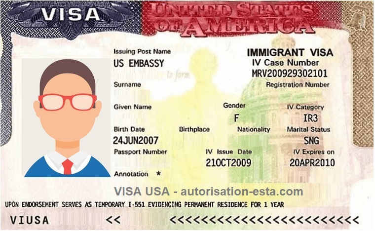 Visa Esta Que Es Image To U